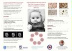 Behan, Claire: Emergency Neurosurgery for Intractable Epilepsy in Pregnancy: A Case Report
