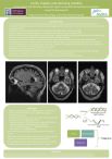 Smyth, Matthew: Frailty, fragility and declining mobility – a case report and literature review of Fragile X-associated tremor/ataxia syndrome