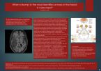 Leer, Martin A.: When a bump in the road identifies a mass in the head; a case report